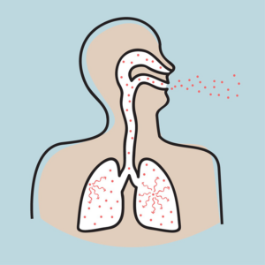 Radon lungs